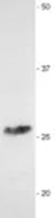 Western blot - Anti-Myelin Protein Zero antibody (AB134439)