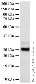 Western blot - Anti-Myelin Protein Zero antibody (AB31851)