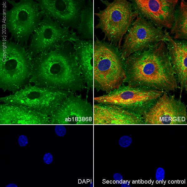 Immunocytochemistry/ Immunofluorescence - Anti-Myelin Protein Zero antibody [EPR20383] (ab183868), expandable thumbnail