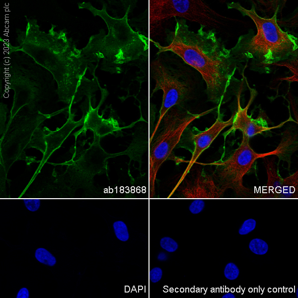 Immunocytochemistry/ Immunofluorescence - Anti-Myelin Protein Zero antibody [EPR20383] (ab183868), expandable thumbnail