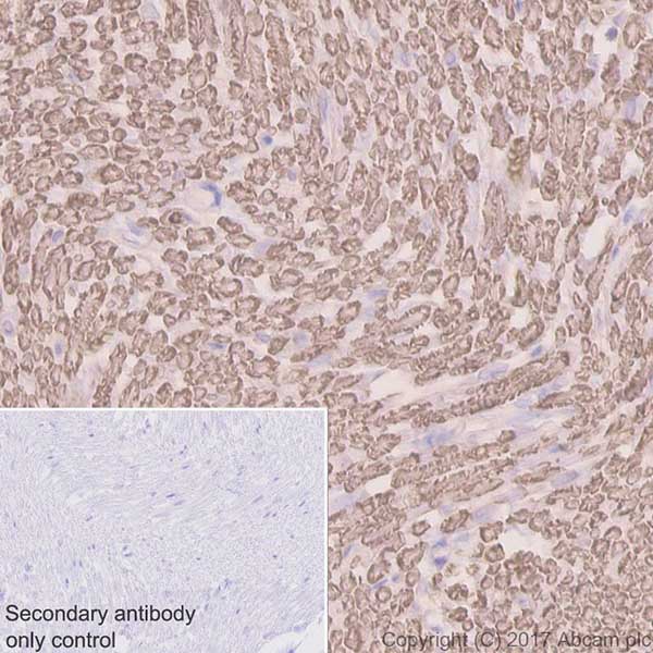 Immunohistochemistry (Formalin/PFA-fixed paraffin-embedded sections) - Anti-Myelin Protein Zero antibody [EPR20383] (ab183868), expandable thumbnail