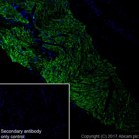Immunohistochemistry (Frozen sections) - Anti-Myelin Protein Zero antibody [EPR20383] (ab183868), expandable thumbnail