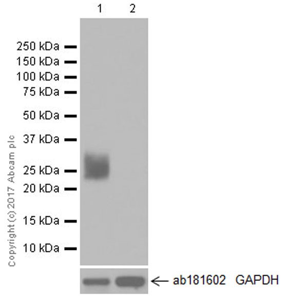 Western blot - Anti-Myelin Protein Zero antibody [EPR20383] (ab183868), expandable thumbnail