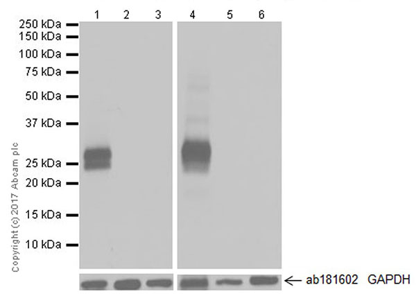 Western blot - Anti-Myelin Protein Zero antibody [EPR20383] (AB183868), expandable thumbnail