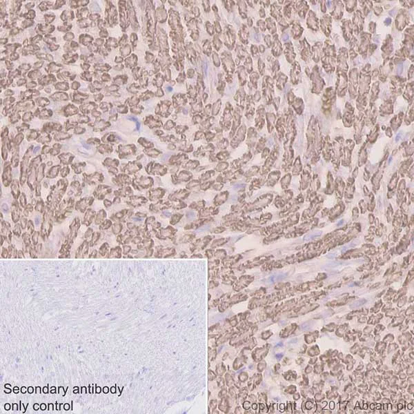 Immunohistochemistry (Formalin/PFA-fixed paraffin-embedded sections) - Anti-Myelin Protein Zero antibody [EPR20383] - BSA and Azide free (AB240279)