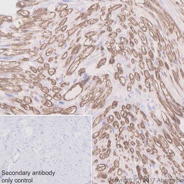 Immunohistochemistry (Formalin/PFA-fixed paraffin-embedded sections) - Anti-Myelin Protein Zero antibody [EPR20383] - BSA and Azide free (AB240279)