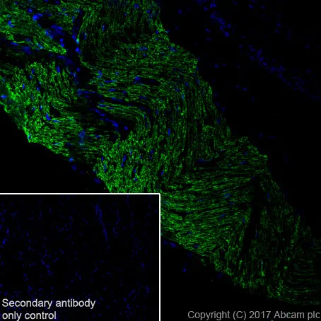 Immunohistochemistry (Frozen sections) - Anti-Myelin Protein Zero antibody [EPR20383] - BSA and Azide free (AB240279)