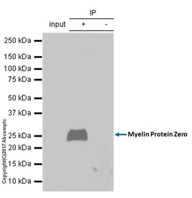 Immunoprecipitation - Anti-Myelin Protein Zero antibody [EPR20383] - BSA and Azide free (AB240279)