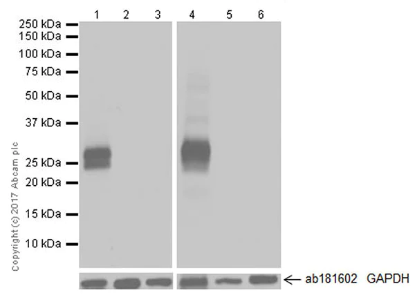 Western blot - Anti-Myelin Protein Zero antibody [EPR20383] - BSA and Azide free (AB240279)