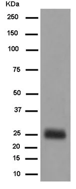 Western blot - Anti-Myelin Protein Zero antibody [EPR8883(2)] - BSA and Azide free (AB250266)