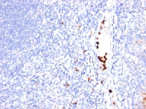 Immunohistochemistry (Formalin/PFA-fixed paraffin-embedded sections) - Anti-Myeloid Marker antibody [MYADM/971] (AB212997)