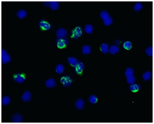 Immunocytochemistry/ Immunofluorescence - Anti-Myeloperoxidase antibody [2D4] (AB90810), expandable thumbnail