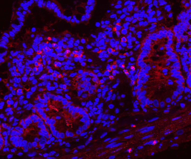 Immunohistochemistry (Formalin/PFA-fixed paraffin-embedded sections) - Anti-Myeloperoxidase antibody (AB65871)