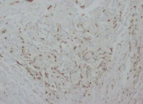 Immunohistochemistry (Formalin/PFA-fixed paraffin-embedded sections) - Anti-Myeloperoxidase antibody (AB65871)