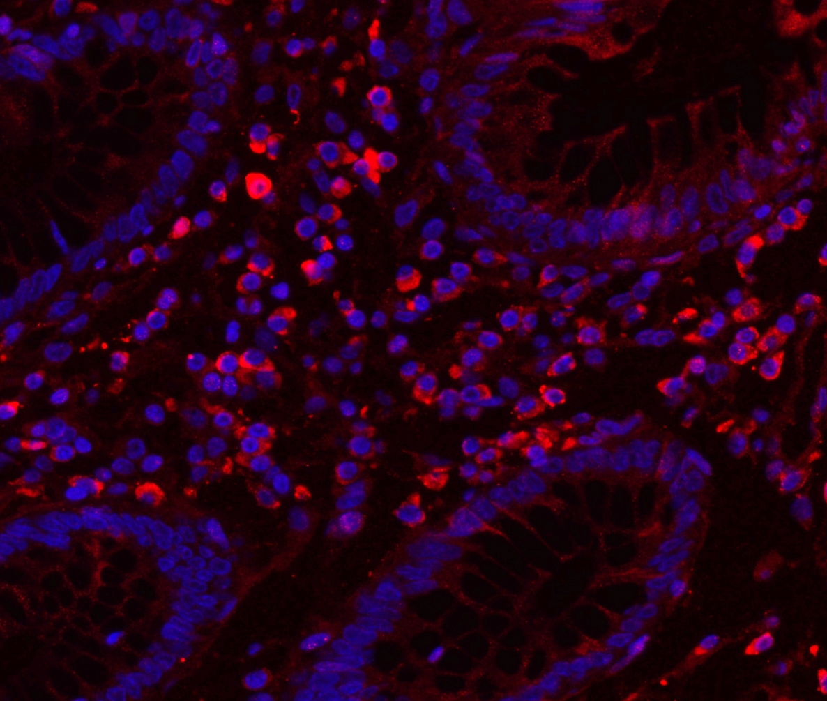 Anti-Myeloperoxidase antibody (ab65871) | Abcam