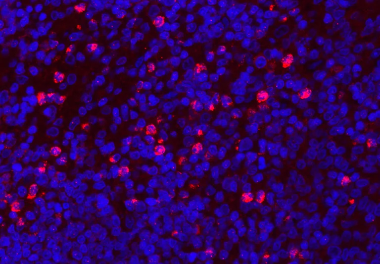 Immunohistochemistry (Formalin/PFA-fixed paraffin-embedded sections) - Anti-Myeloperoxidase antibody (AB65871)
