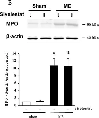 Western blot - Anti-Myeloperoxidase antibody (AB65871)