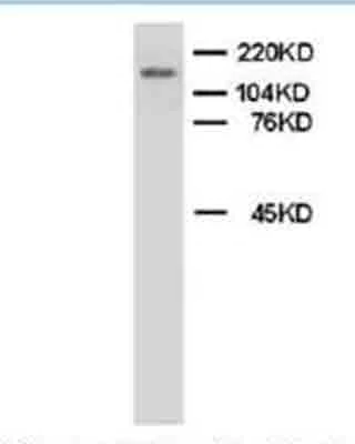 Western blot - Anti-Myeloperoxidase antibody (AB65871)