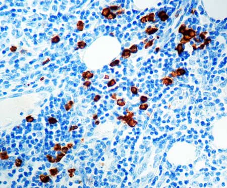 Immunohistochemistry (Formalin/PFA-fixed paraffin-embedded sections) - Anti-Myeloperoxidase antibody (AB9535)