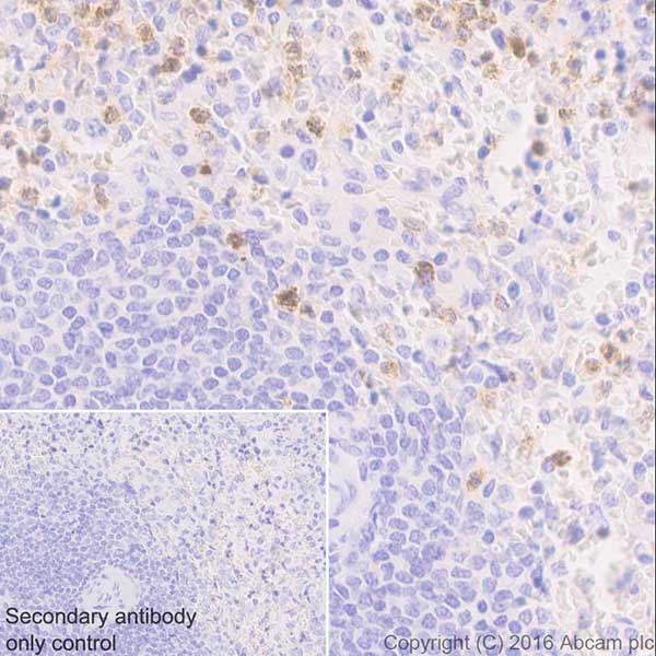 Immunohistochemistry (Formalin/PFA-fixed paraffin-embedded sections) - Anti-Myeloperoxidase antibody [EPR17996] (AB188211), expandable thumbnail
