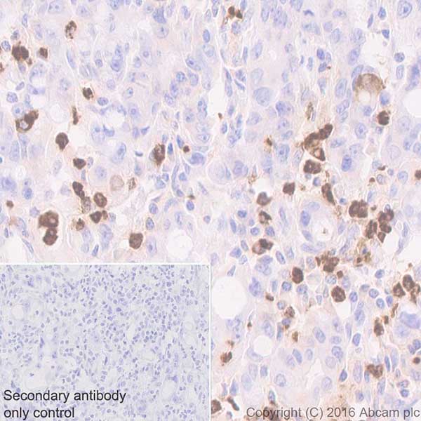 Immunohistochemistry (Formalin/PFA-fixed paraffin-embedded sections) - Anti-Myeloperoxidase antibody [EPR20257] - BSA and Azide free (AB221847), expandable thumbnail