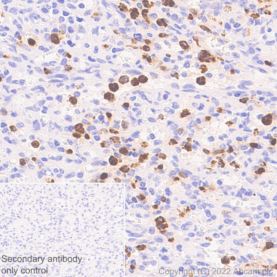Immunohistochemistry (Formalin/PFA-fixed paraffin-embedded sections) - Anti-Myeloperoxidase antibody [EPR20257] - Rat IgG2a (Chimeric) (AB300650), expandable thumbnail