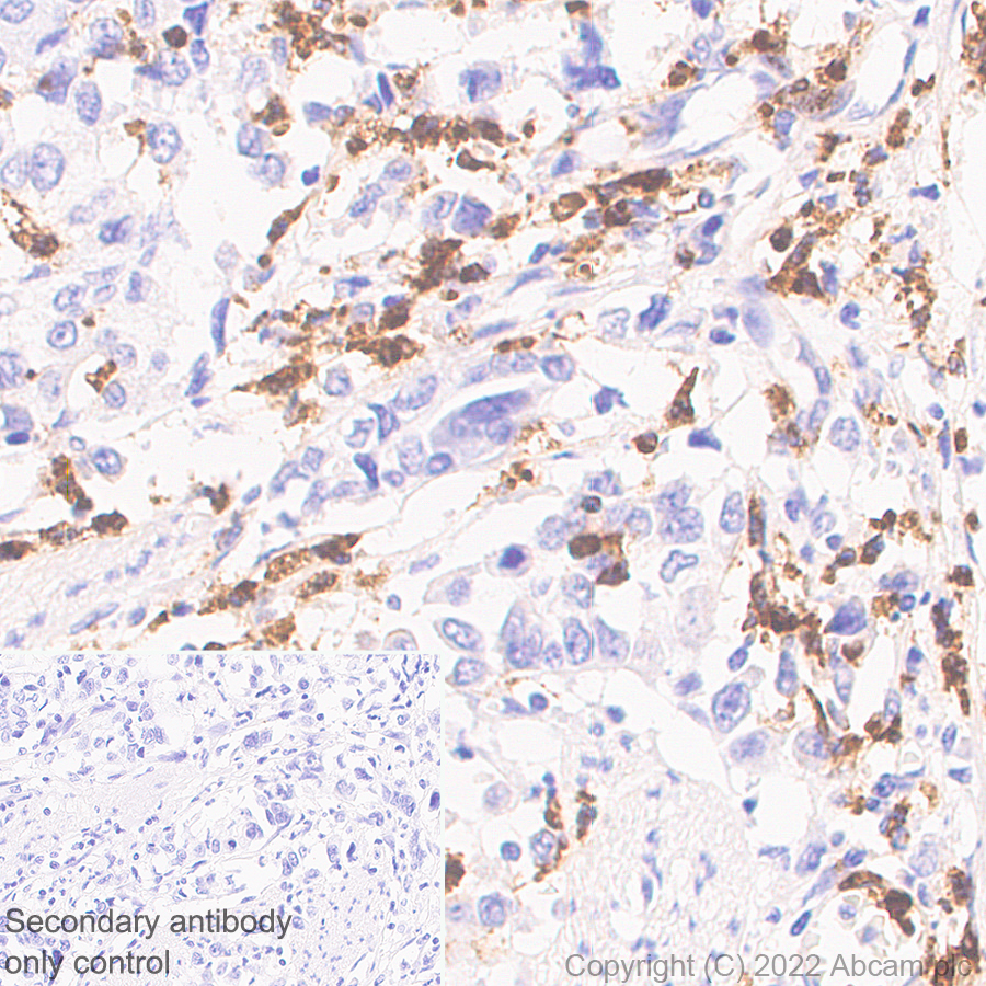 Immunohistochemistry (Formalin/PFA-fixed paraffin-embedded sections) - Anti-Myeloperoxidase antibody [EPR20257] - Rat IgG2a (Chimeric) (AB300650), expandable thumbnail
