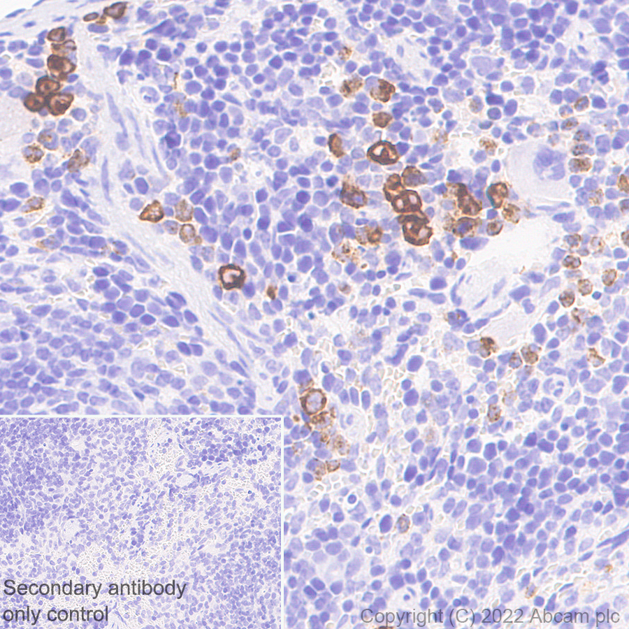 Immunohistochemistry (Formalin/PFA-fixed paraffin-embedded sections) - Anti-Myeloperoxidase antibody [EPR20257] - Rat IgG2a (Chimeric) (AB300650), expandable thumbnail