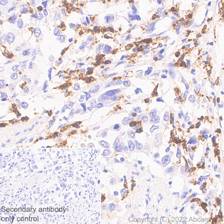 Immunohistochemistry (Formalin/PFA-fixed paraffin-embedded sections) - Anti-Myeloperoxidase antibody [EPR20257] - Rat IgG2a (Chimeric) - BSA and Azide free (AB300651)