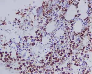 Immunohistochemistry (Formalin/PFA-fixed paraffin-embedded sections) - Anti-Myeloperoxidase antibody [EPR4792] (AB109116)