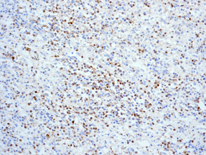 Immunohistochemistry (Formalin/PFA-fixed paraffin-embedded sections) - Anti-Myeloperoxidase antibody [EPR4792] (AB109116), expandable thumbnail