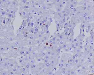 Immunohistochemistry (Formalin/PFA-fixed paraffin-embedded sections) - Anti-Myeloperoxidase antibody [EPR4792] (AB109116)