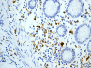 Immunohistochemistry (Formalin/PFA-fixed paraffin-embedded sections) - Anti-Myeloperoxidase antibody [EPR4792] (AB109116), expandable thumbnail