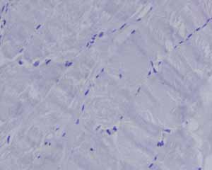 Immunohistochemistry (Formalin/PFA-fixed paraffin-embedded sections) - Anti-Myeloperoxidase antibody [EPR4792] (ab109116), expandable thumbnail