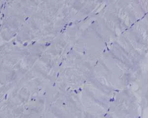 Immunohistochemistry (Formalin/PFA-fixed paraffin-embedded sections) - Anti-Myeloperoxidase antibody [EPR4792] (AB109116)