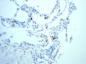 Immunohistochemistry (Formalin/PFA-fixed paraffin-embedded sections) - Anti-Myeloperoxidase antibody [EPR4792] - BSA and Azide free (AB247766)