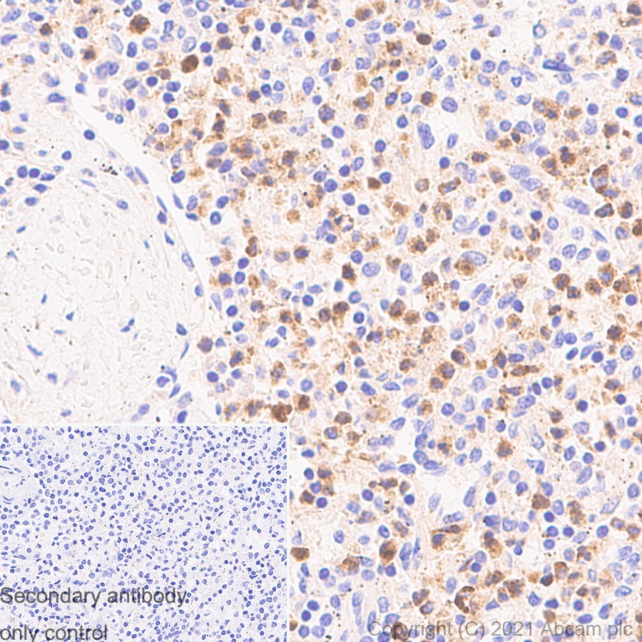 Immunohistochemistry (Formalin/PFA-fixed paraffin-embedded sections) - Anti-Myeloperoxidase antibody [EPR4793] (AB134132), expandable thumbnail