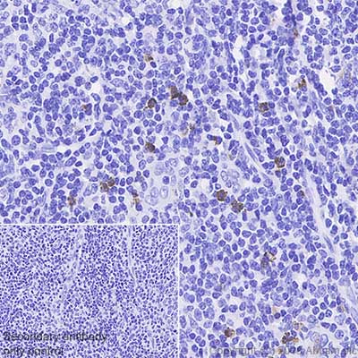 Immunohistochemistry (Formalin/PFA-fixed paraffin-embedded sections) - Anti-Myeloperoxidase antibody [SP72] (AB93665), expandable thumbnail