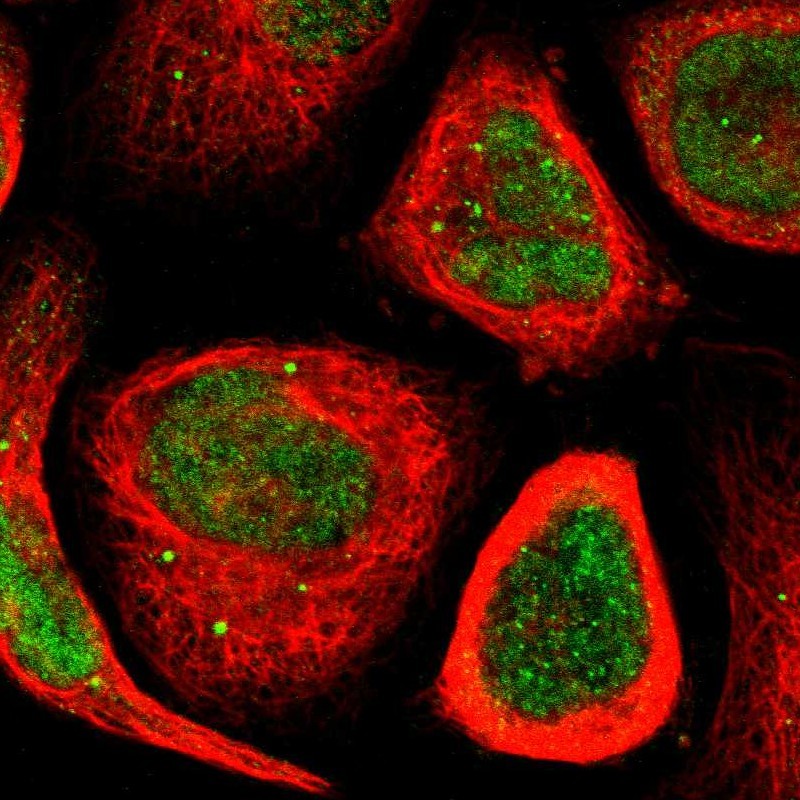 Immunocytochemistry/ Immunofluorescence - Anti-MYEOV antibody (AB121387), expandable thumbnail