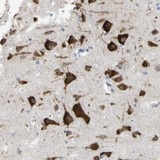 Immunohistochemistry (Formalin/PFA-fixed paraffin-embedded sections) - Anti-MYEOV antibody (AB121387), expandable thumbnail