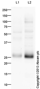 Western blot - Anti-Myf5 antibody (AB125301), expandable thumbnail