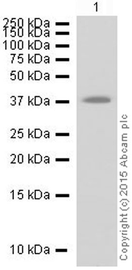 Western blot - Anti-Myf5 antibody [EPR4899] (AB125078)
