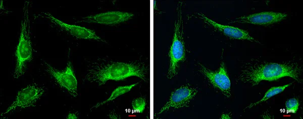 Immunocytochemistry/ Immunofluorescence - Anti-MYH/MUTYH antibody (AB228722)