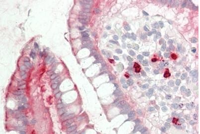 Immunohistochemistry (Formalin/PFA-fixed paraffin-embedded sections) - Anti-Myh14 antibody (AB230418)