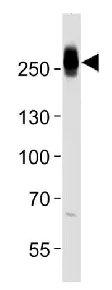 Western blot - Anti-Myh14 antibody (AB230418)