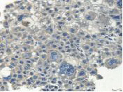 Immunohistochemistry (Formalin/PFA-fixed paraffin-embedded sections) - Anti-Myh14 antibody (AB232897)