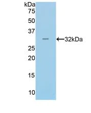 Western blot - Anti-Myh14 antibody (AB232897)