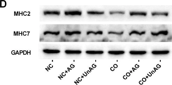 Western blot - Anti-MYH2 antibody [EPR5280] (AB124937)