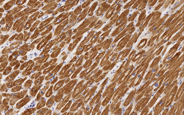 Immunohistochemistry (Formalin/PFA-fixed paraffin-embedded sections) - Anti-MYH6 antibody [3-48 G5C7] (AB207926), expandable thumbnail