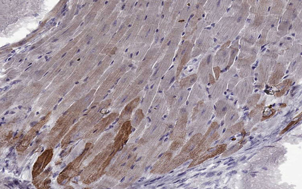 Immunohistochemistry (Formalin/PFA-fixed paraffin-embedded sections) - Anti-MYH6 antibody [3-48 G5C7] (AB207926), expandable thumbnail
